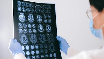 Mujer médico sujetando entre sus manos y observando una radiografía del cerebro